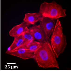 Calcium Imaging at Ecole des Mines de Saint-Etienne 配图 1